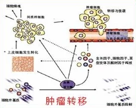 cf残端在肿瘤微环境中的作用及其对免疫治疗的影响研究综述